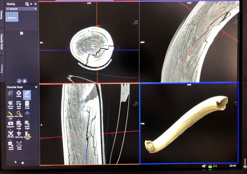 Innenansicht durch die Computertomographie