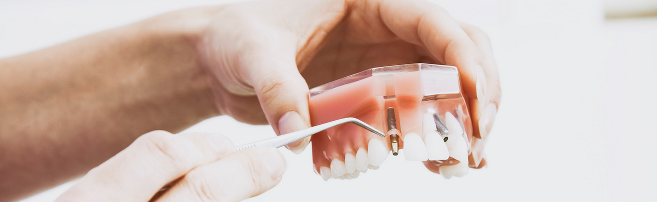 Fachzahntechniker Kieferothopädie